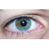 HIRA™ EYESCAN