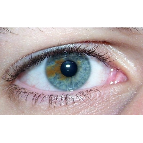 HIRA™ EYESCAN